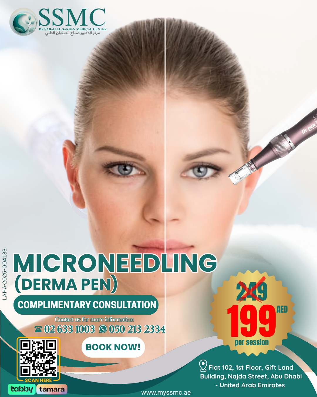 microneedling
